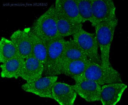 HUABIO ET7106-84 image 2