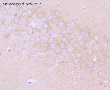 HUABIO ET7106-84 image 3