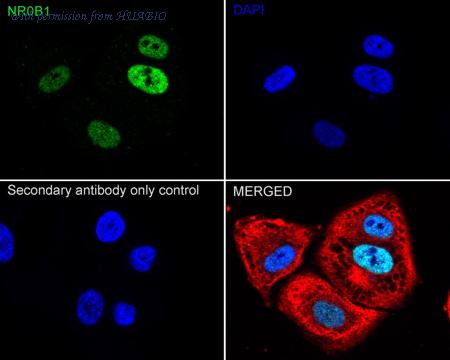 HUABIO ET7106-85 image 2