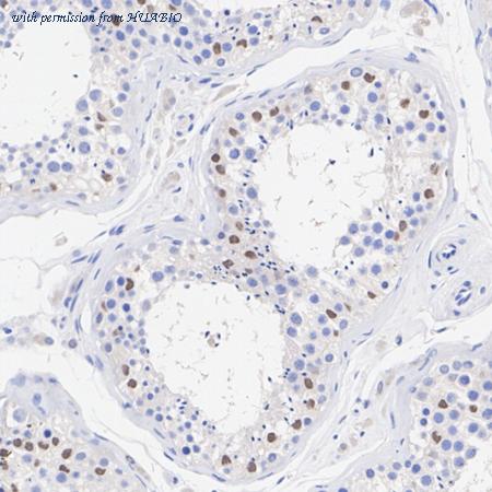 HUABIO ET7106-85 image 3