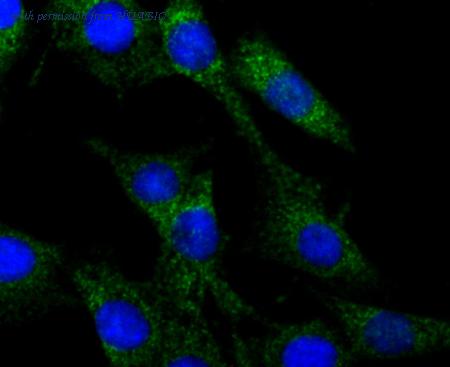 HUABIO ET7106-86 image 3