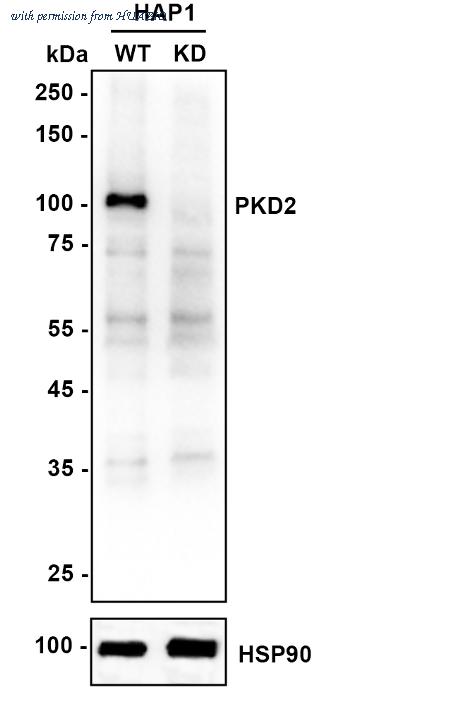 HUABIO ET7106-87 image 1
