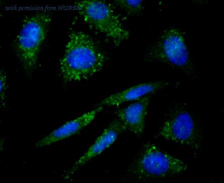 HUABIO ET7106-87 image 2