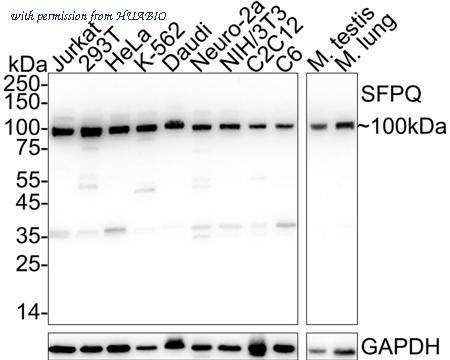HUABIO ET7107-02 image 1