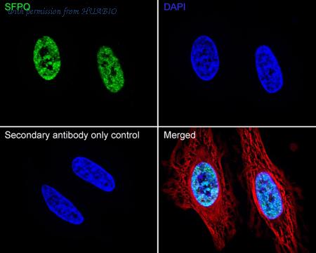 HUABIO ET7107-02 image 2