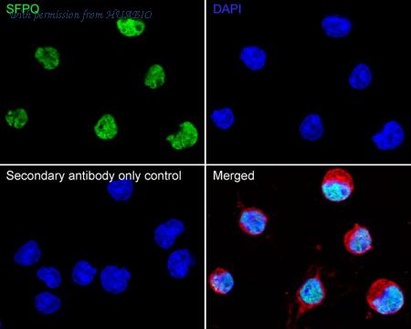 HUABIO ET7107-02 image 3