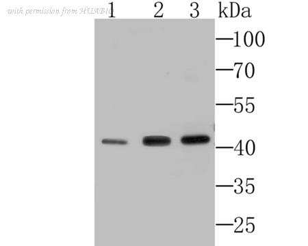 HUABIO ET7107-05 image 1