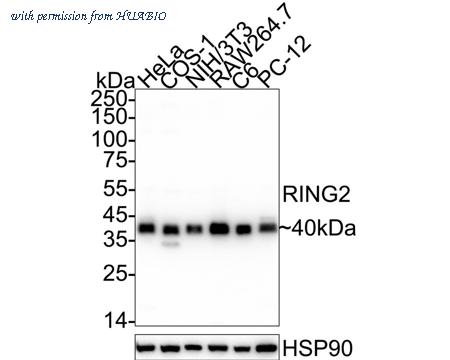 HUABIO ET7107-07 image 1