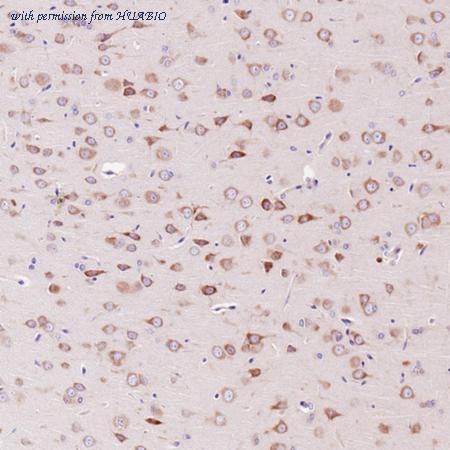 HUABIO ET7107-08 image 3