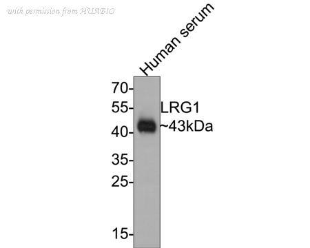 HUABIO ET7107-11 image 1