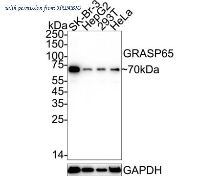 HUABIO ET7107-13 image 1