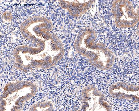 HUABIO ET7107-13 image 3