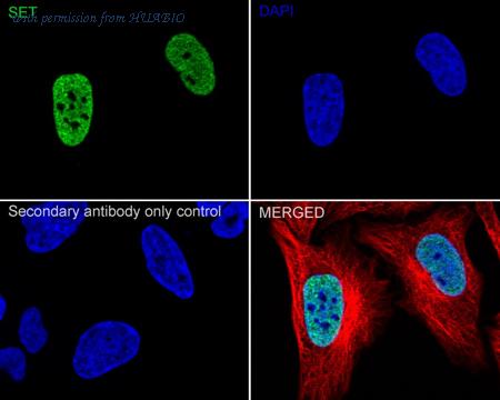 HUABIO ET7107-18 image 2