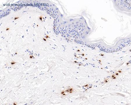 HUABIO ET7107-19 image 3