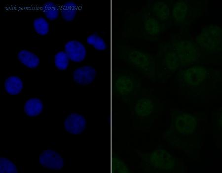 HUABIO ET7108-11 image 3