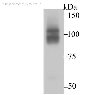 HUABIO ET7108-14 image 1