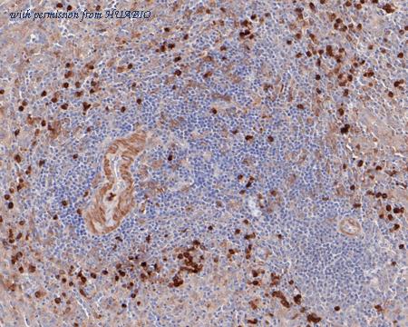 HUABIO ET7108-72 image 3