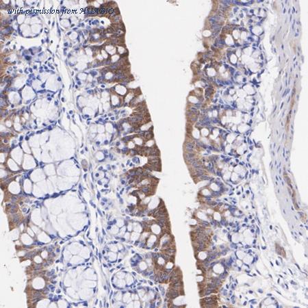 HUABIO ET7108-73 image 2