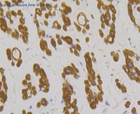 HUABIO ET7108-74 image 3