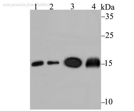 HUABIO ET7108-75 image 1