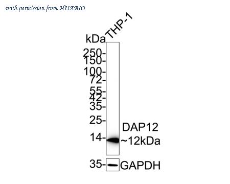 HUABIO ET7108-76 image 1