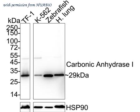 HUABIO ET7108-77 image 1