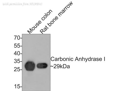 HUABIO ET7108-77 image 2