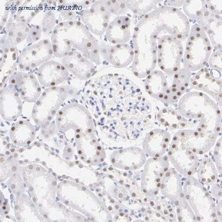 HUABIO ET7108-80 image 3