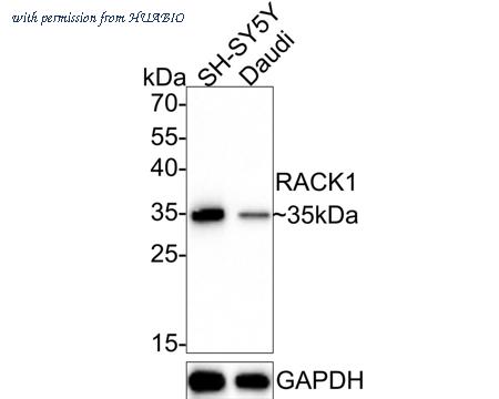HUABIO ET7109-04 image 2