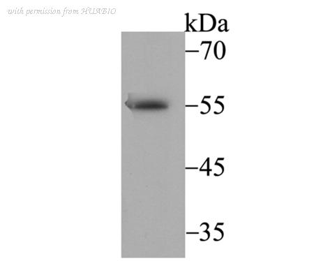 HUABIO ET7109-23 image 1