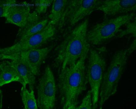 HUABIO ET7109-25 image 3