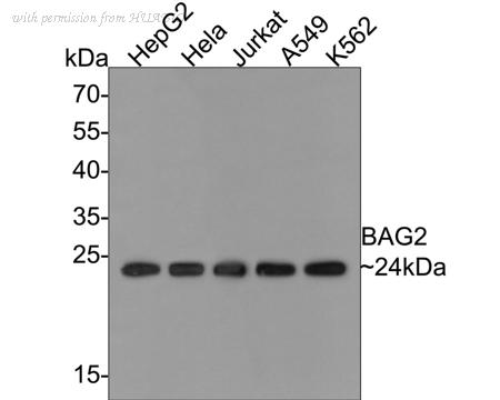 HUABIO ET7109-62 image 1