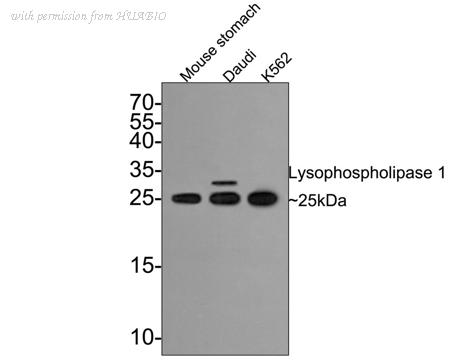 HUABIO ET7109-63 image 1