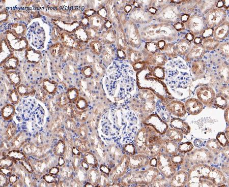 HUABIO ET7109-63 image 3