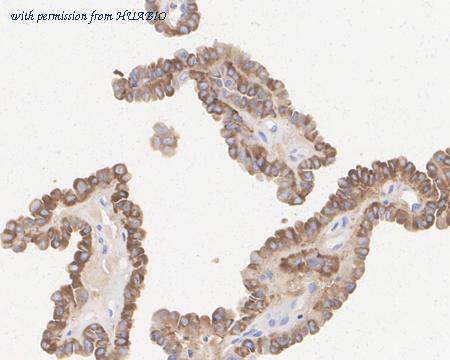 HUABIO ET7109-64 image 2