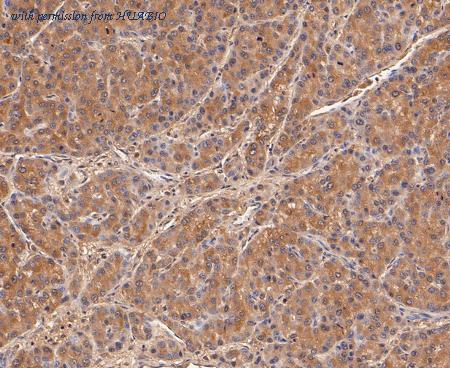 HUABIO ET7109-66 image 2