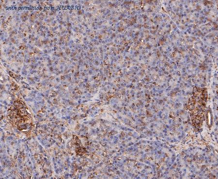 HUABIO ET7109-66 image 3