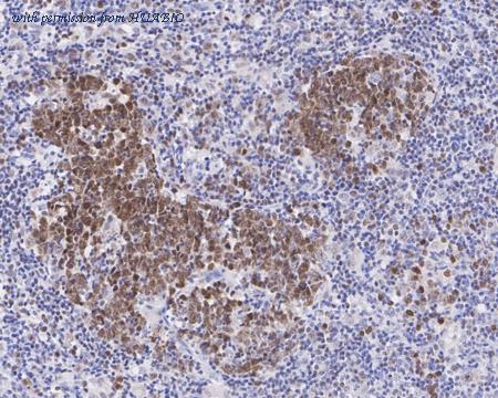 HUABIO ET7109-68 image 2