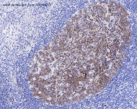 HUABIO ET7109-68 image 3