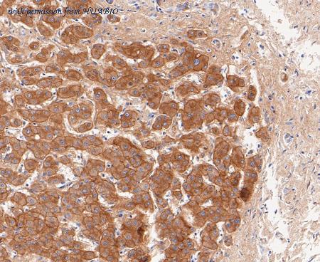 HUABIO ET7109-69 image 1