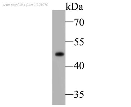 HUABIO ET7109-70 image 1