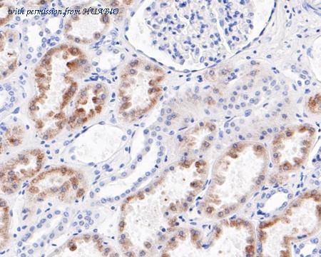 HUABIO ET7109-70 image 2