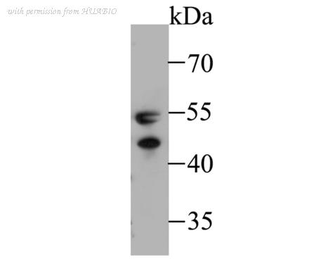 HUABIO ET7109-73 image 1