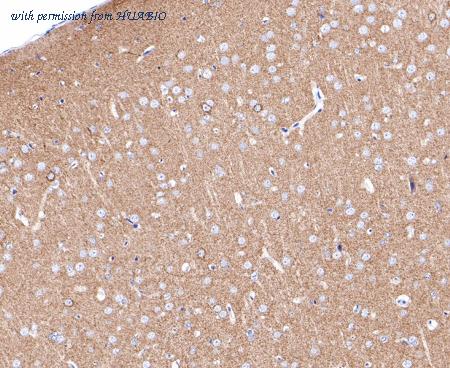 HUABIO ET7109-75 image 3