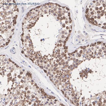 HUABIO ET7109-76 image 3