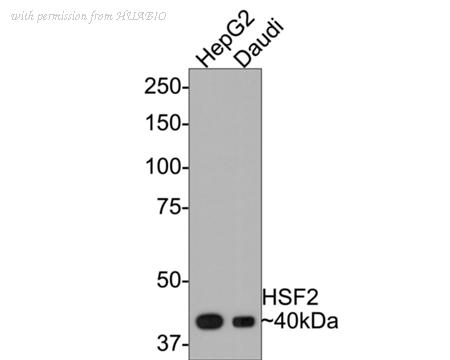 HUABIO ET7109-78 image 1