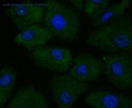 HUABIO ET7109-89 image 2