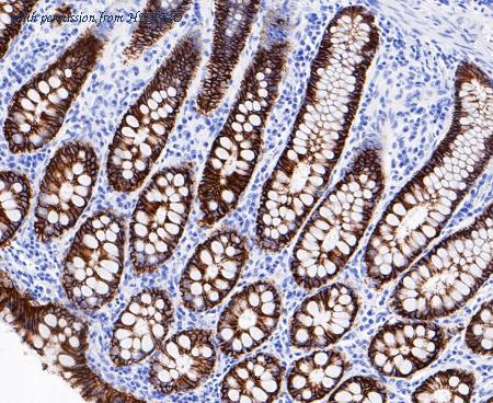 HUABIO ET7109-93 image 2