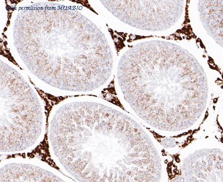 HUABIO ET7109-98 image 2