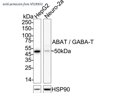 HUABIO ET7110-01 image 1